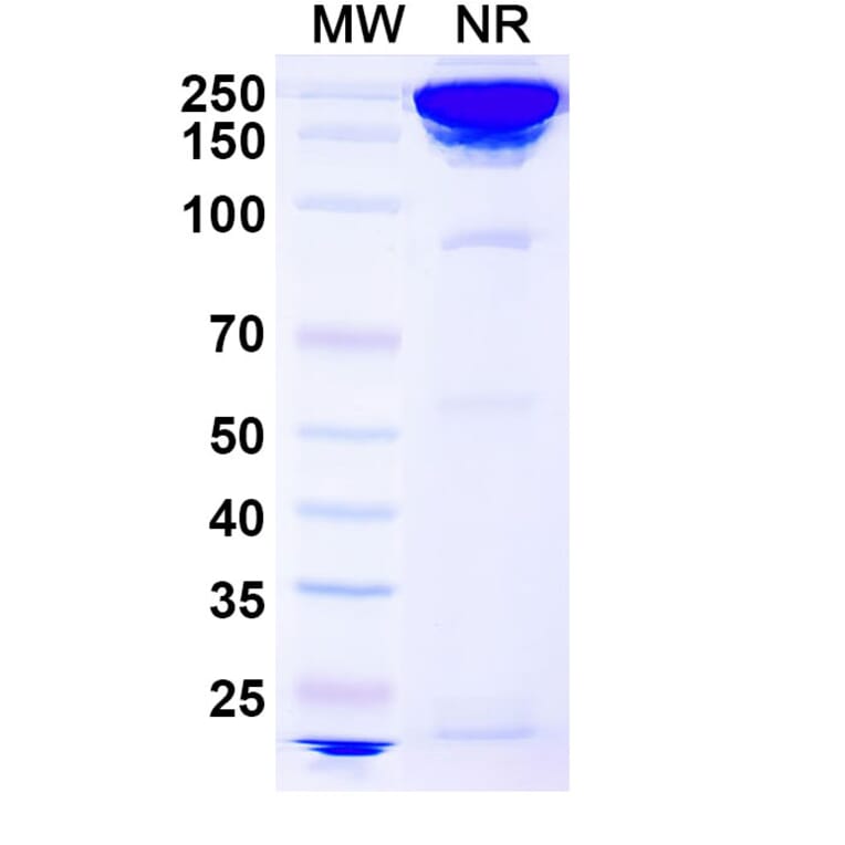 SDS-PAGE - Concizumab Biosimilar - Anti-TFPI Antibody - BSA and Azide free (A338740) - Antibodies.com