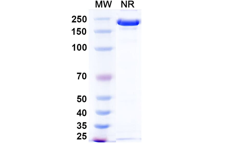 SDS-PAGE - Ponezumab Biosimilar - Anti-APP Antibody - BSA and Azide free (A338749) - Antibodies.com