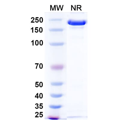 SDS-PAGE - Ponezumab Biosimilar - Anti-APP Antibody - BSA and Azide free (A338749) - Antibodies.com