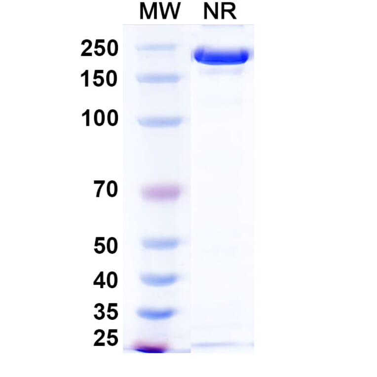 SDS-PAGE - Ponezumab Biosimilar - Anti-APP Antibody - BSA and Azide free (A338749) - Antibodies.com