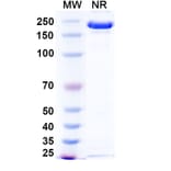 SDS-PAGE - Ponezumab Biosimilar - Anti-APP Antibody - BSA and Azide free (A338749) - Antibodies.com