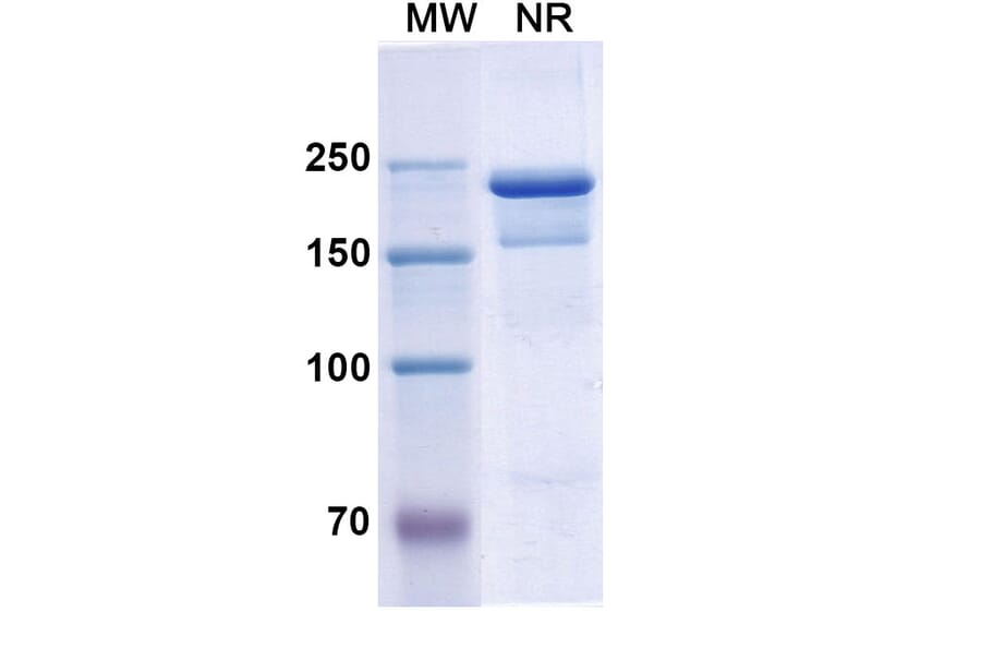 SDS-PAGE - Semorinemab Biosimilar - Anti-Tau Antibody - BSA and Azide free (A338753) - Antibodies.com