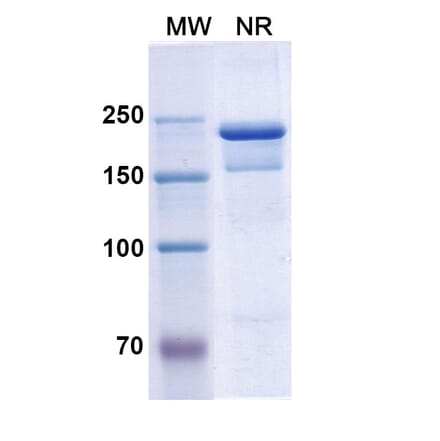 SDS-PAGE - Semorinemab Biosimilar - Anti-Tau Antibody - BSA and Azide free (A338753) - Antibodies.com
