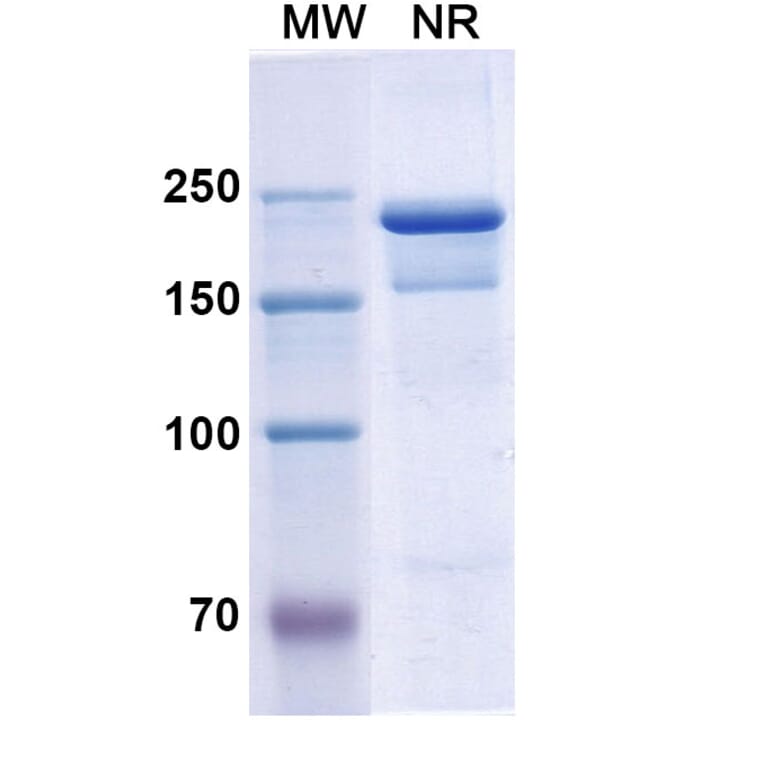 SDS-PAGE - Semorinemab Biosimilar - Anti-Tau Antibody - BSA and Azide free (A338753) - Antibodies.com