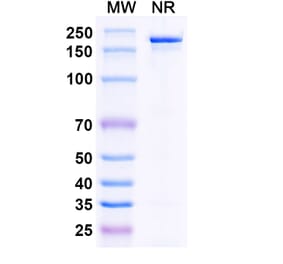 SDS-PAGE - Bepranemab Biosimilar - Anti-Tau Antibody - BSA and Azide free (A338754) - Antibodies.com