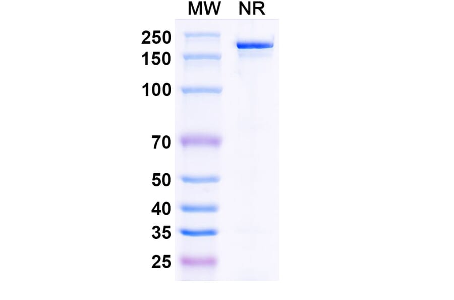 SDS-PAGE - Bepranemab Biosimilar - Anti-Tau Antibody - BSA and Azide free (A338754) - Antibodies.com