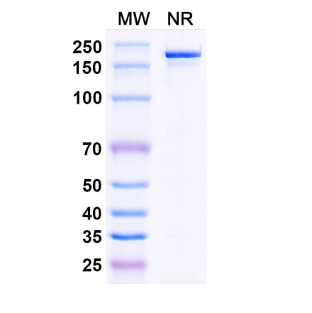 SDS-PAGE - Bepranemab Biosimilar - Anti-Tau Antibody - BSA and Azide free (A338754) - Antibodies.com