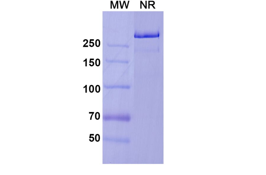 SDS-PAGE - Prasinezumab Biosimilar - Anti-alpha Synuclein Antibody - BSA and Azide free (A338756) - Antibodies.com