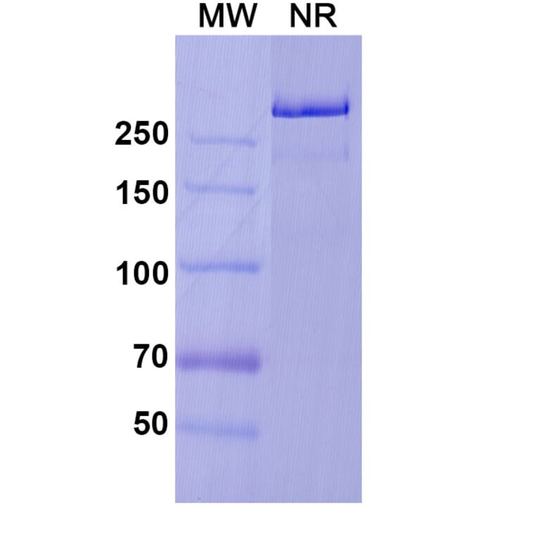 SDS-PAGE - Prasinezumab Biosimilar - Anti-alpha Synuclein Antibody - BSA and Azide free (A338756) - Antibodies.com