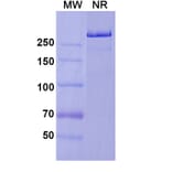 SDS-PAGE - Prasinezumab Biosimilar - Anti-alpha Synuclein Antibody - BSA and Azide free (A338756) - Antibodies.com