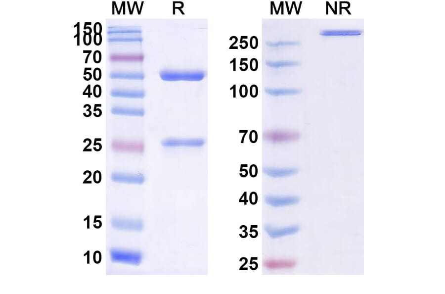 SDS-PAGE - Pintumomab Biosimilar - Anti-DPEP3 Antibody - BSA and Azide free (A338757) - Antibodies.com