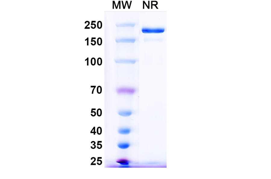 SDS-PAGE - Pintumomab Biosimilar - Anti-DPEP3 Antibody - BSA and Azide free (A338757) - Antibodies.com