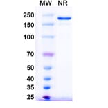 SDS-PAGE - Pintumomab Biosimilar - Anti-DPEP3 Antibody - BSA and Azide free (A338757) - Antibodies.com