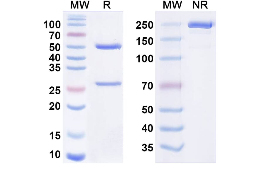 SDS-PAGE - Tamrintamab Biosimilar - Anti-DPEP3 Antibody - BSA and Azide free (A338758) - Antibodies.com