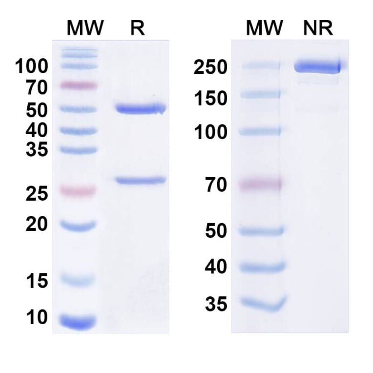 SDS-PAGE - Tamrintamab Biosimilar - Anti-DPEP3 Antibody - BSA and Azide free (A338758) - Antibodies.com