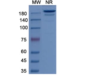 SDS-PAGE - Girentuximab Biosimilar - Anti-CA9 Antibody - BSA and Azide free (A338760) - Antibodies.com