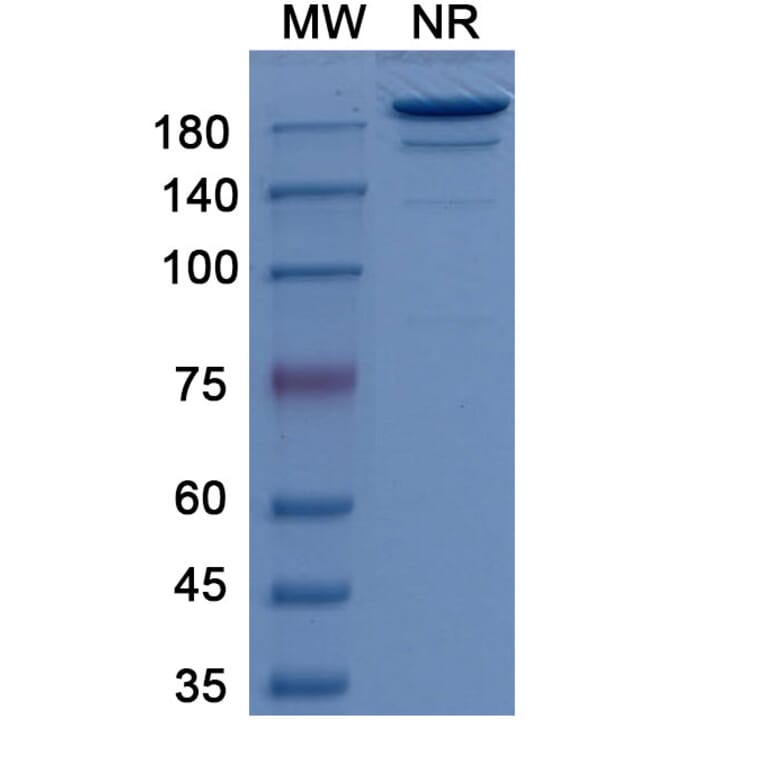 SDS-PAGE - Girentuximab Biosimilar - Anti-CA9 Antibody - BSA and Azide free (A338760) - Antibodies.com