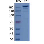 SDS-PAGE - Girentuximab Biosimilar - Anti-CA9 Antibody - BSA and Azide free (A338760) - Antibodies.com
