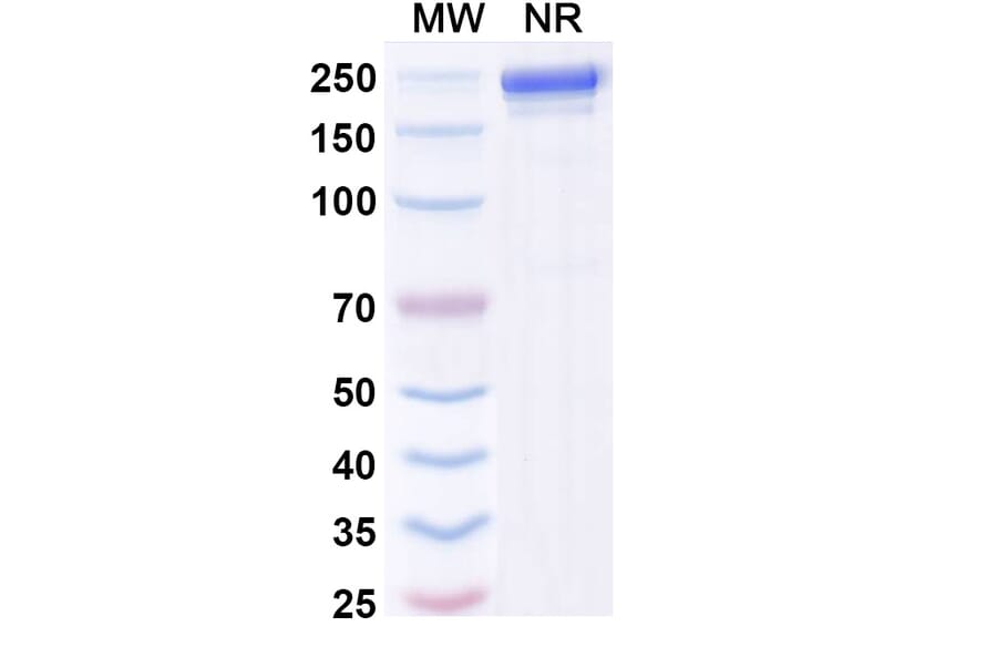SDS-PAGE - Andecaliximab Biosimilar - Anti-MMP9 Antibody - BSA and Azide free (A338761) - Antibodies.com