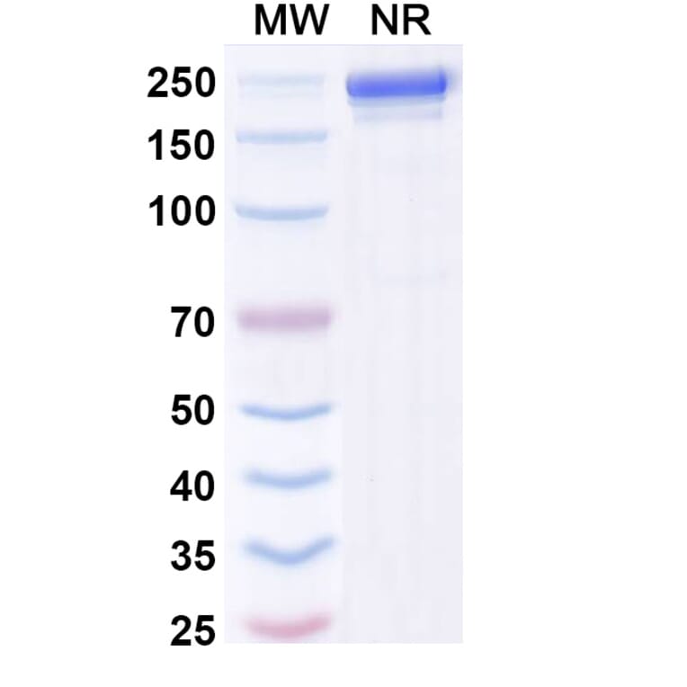 SDS-PAGE - Andecaliximab Biosimilar - Anti-MMP9 Antibody - BSA and Azide free (A338761) - Antibodies.com