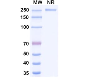 SDS-PAGE - Patritumab Biosimilar - Anti-ErbB3 Antibody - BSA and Azide free (A338765) - Antibodies.com