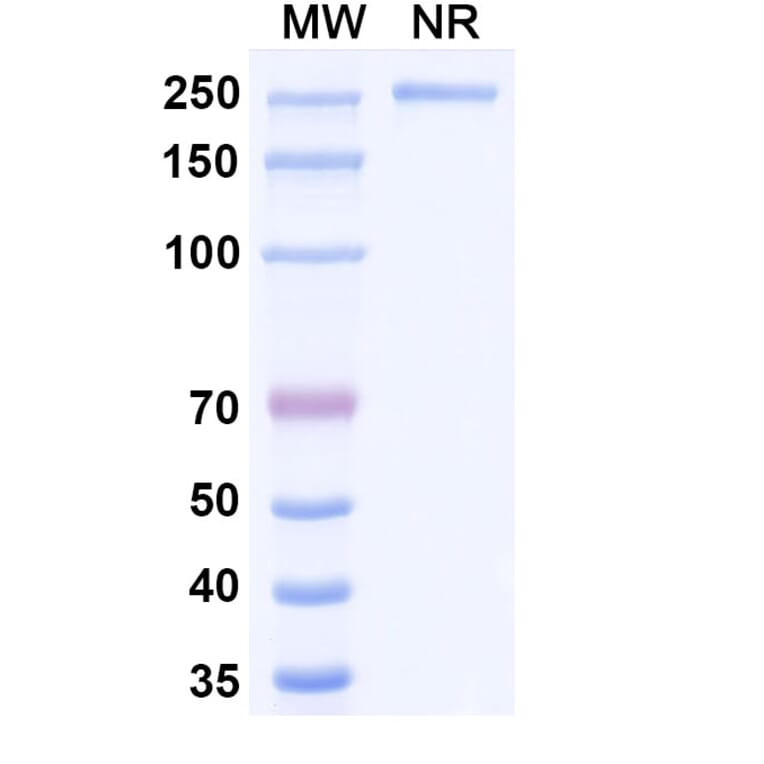 SDS-PAGE - Patritumab Biosimilar - Anti-ErbB3 Antibody - BSA and Azide free (A338765) - Antibodies.com
