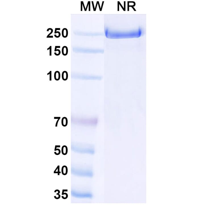 SDS-PAGE - Emibetuzumab Biosimilar - Anti-c-Met Antibody - BSA and Azide free (A338779) - Antibodies.com