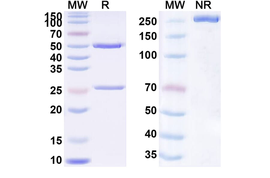 SDS-PAGE - Timolumab Biosimilar - Anti-AOC3 Antibody - BSA and Azide free (A338782) - Antibodies.com