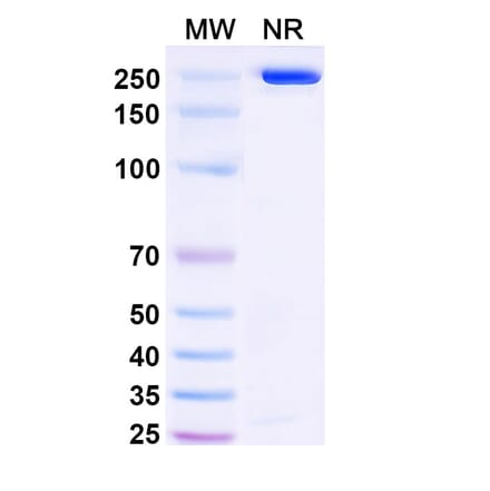 SDS-PAGE - Anetumab Biosimilar - Anti-Mesothelin Antibody - BSA and Azide free (A338805) - Antibodies.com