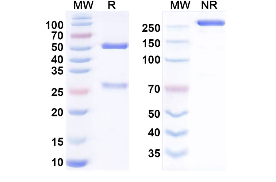 SDS-PAGE - Enapotamab Biosimilar - Anti-Axl Antibody - BSA and Azide free (A338809) - Antibodies.com