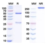 SDS-PAGE - Enapotamab Biosimilar - Anti-Axl Antibody - BSA and Azide free (A338809) - Antibodies.com