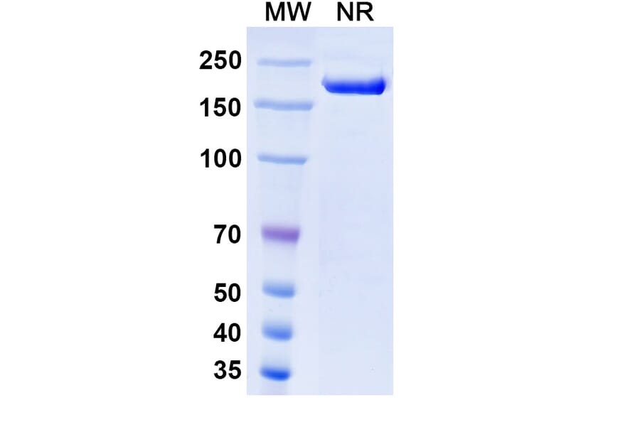 SDS-PAGE - Rosopatamab Biosimilar - Anti-PSMA Antibody - BSA and Azide free (A338813) - Antibodies.com