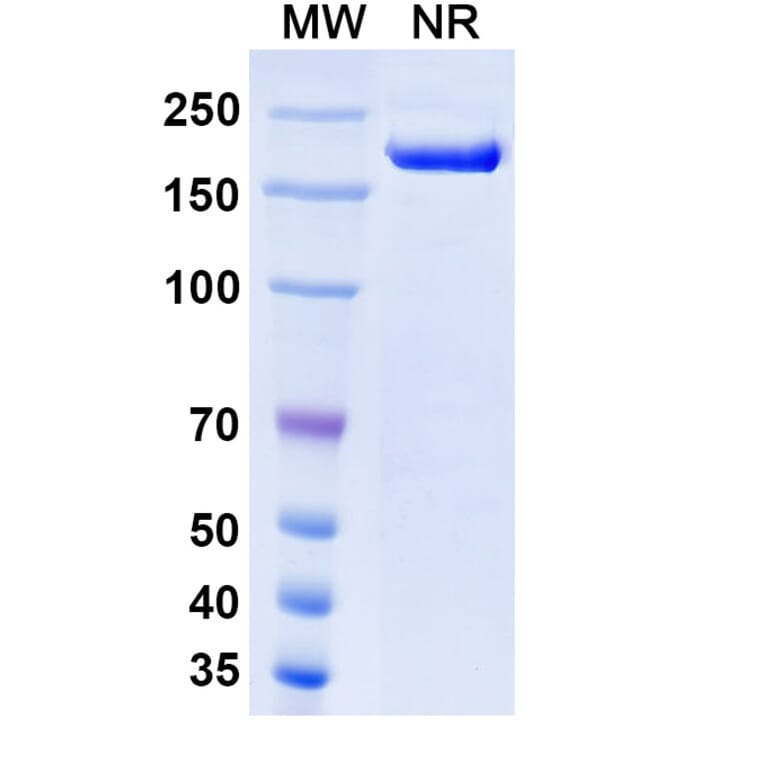 SDS-PAGE - Rosopatamab Biosimilar - Anti-PSMA Antibody - BSA and Azide free (A338813) - Antibodies.com