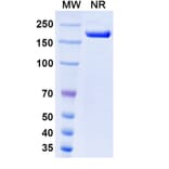 SDS-PAGE - Rosopatamab Biosimilar - Anti-PSMA Antibody - BSA and Azide free (A338813) - Antibodies.com