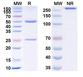 SDS-PAGE - Dezamizumab Biosimilar - Anti-SAP Antibody - BSA and Azide free (A338814) - Antibodies.com