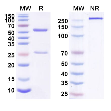 SDS-PAGE - Flanvotumab Biosimilar - Anti-TRP1 Antibody - BSA and Azide free (A338817) - Antibodies.com