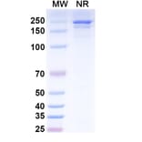 SDS-PAGE - Ifabotuzumab Biosimilar - Anti-EphA3 Antibody - BSA and Azide free (A338822) - Antibodies.com