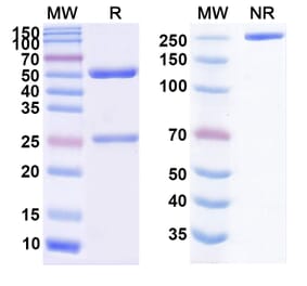 SDS-PAGE - Upifitamab Biosimilar - Anti-SLC34A2 Antibody - BSA and Azide free (A338825) - Antibodies.com