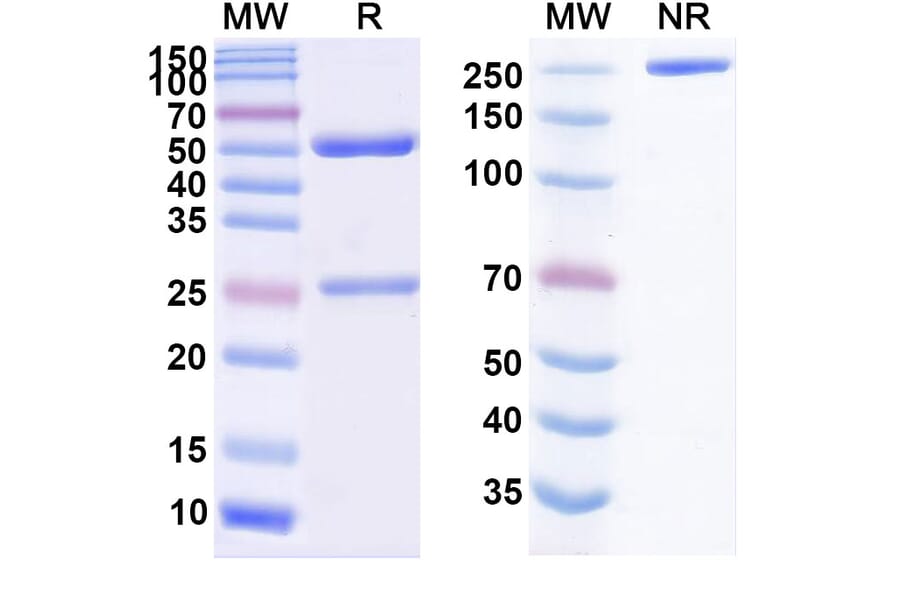 SDS-PAGE - Upifitamab Biosimilar - Anti-SLC34A2 Antibody - BSA and Azide free (A338825) - Antibodies.com