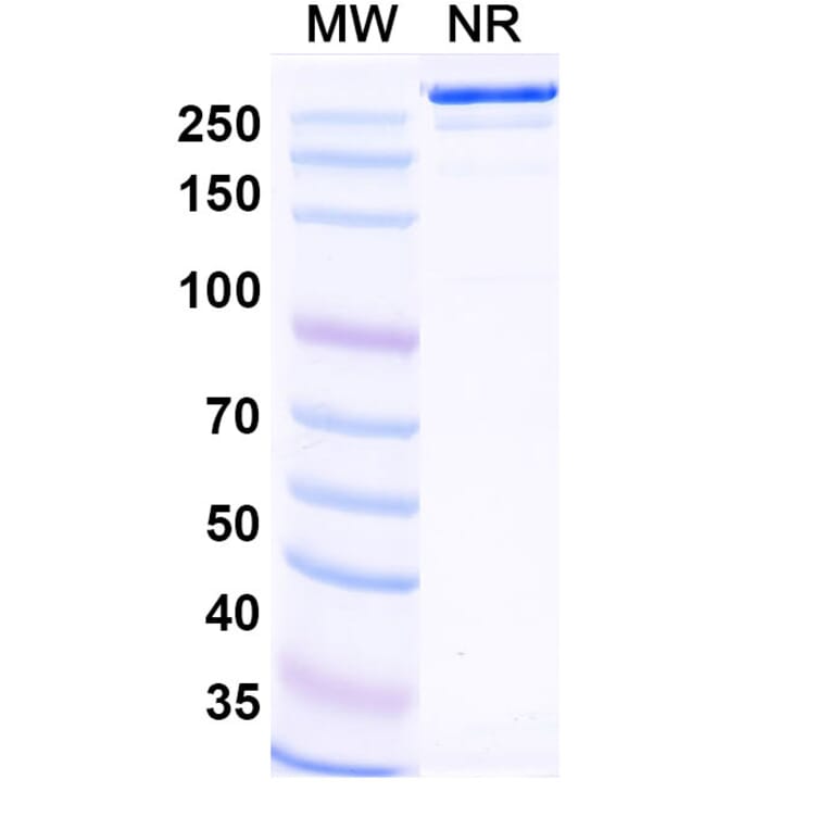 SDS-PAGE - Narsoplimab Biosimilar - Anti-MASP2 Antibody - BSA and Azide free (A338831) - Antibodies.com