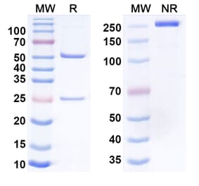 SDS-PAGE - Ontamalimab Biosimilar - Anti-MAdCAM1 Antibody - BSA and Azide free (A338836) - Antibodies.com