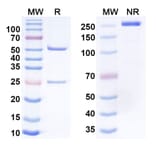 SDS-PAGE - Ontamalimab Biosimilar - Anti-MAdCAM1 Antibody - BSA and Azide free (A338836) - Antibodies.com