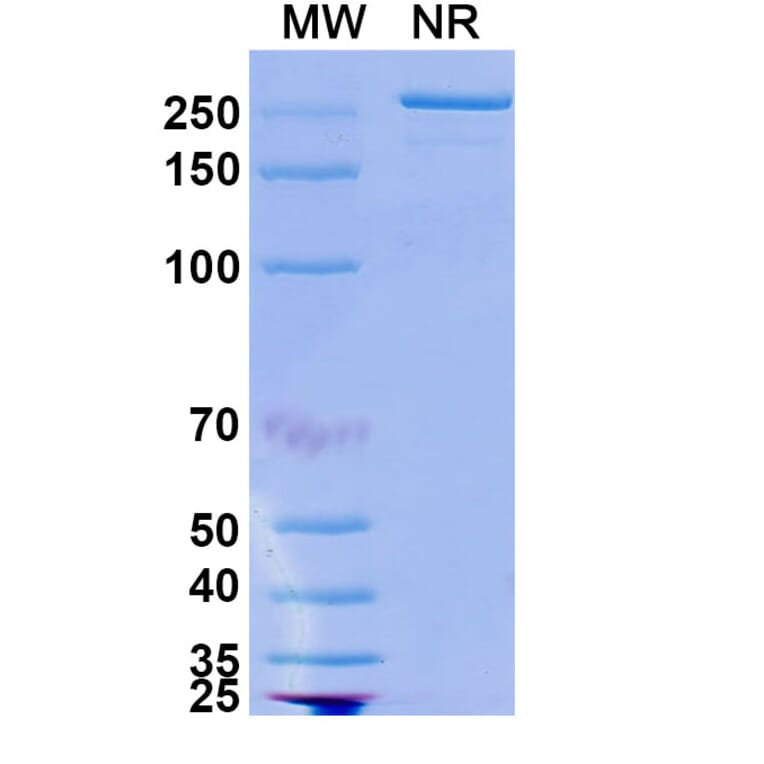 SDS-PAGE - Opicinumab Biosimilar - Anti-LINGO1 Antibody - BSA and Azide free (A338838) - Antibodies.com