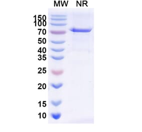 SDS-PAGE - Radretumab Biosimilar - Anti-Fibronectin Antibody - BSA and Azide free (A338840) - Antibodies.com