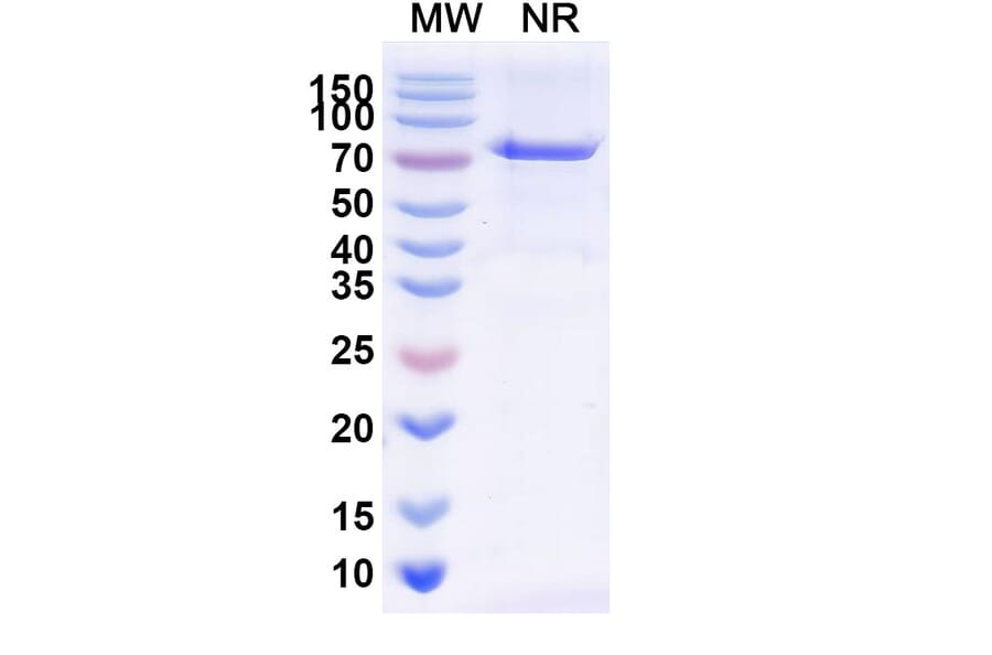 SDS-PAGE - Radretumab Biosimilar - Anti-Fibronectin Antibody - BSA and Azide free (A338840) - Antibodies.com