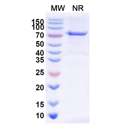 SDS-PAGE - Radretumab Biosimilar - Anti-Fibronectin Antibody - BSA and Azide free (A338840) - Antibodies.com