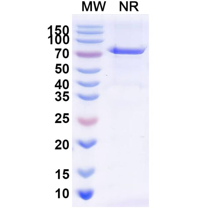 SDS-PAGE - Radretumab Biosimilar - Anti-Fibronectin Antibody - BSA and Azide free (A338840) - Antibodies.com