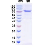 SDS-PAGE - Radretumab Biosimilar - Anti-Fibronectin Antibody - BSA and Azide free (A338840) - Antibodies.com