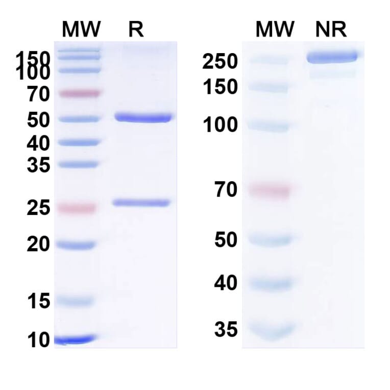 SDS-PAGE - Birtamimab Biosimilar - Anti-SAA1 Antibody - BSA and Azide free (A338843) - Antibodies.com