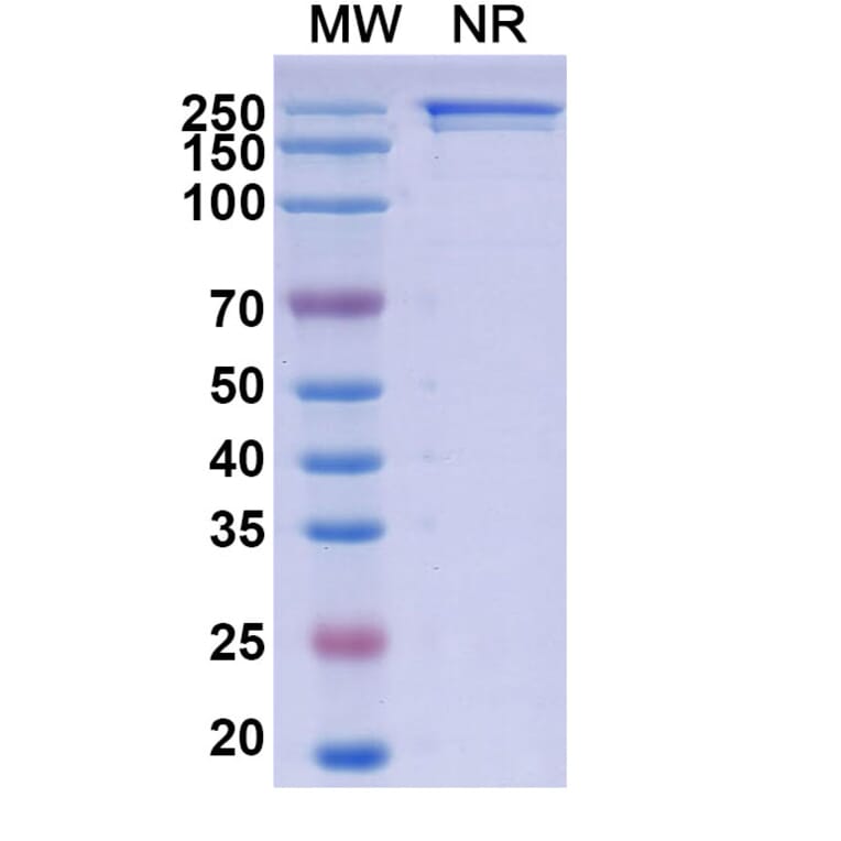 SDS-PAGE - Sibrotuzumab Biosimilar - Anti-FAP Antibody - BSA and Azide free (A338850) - Antibodies.com